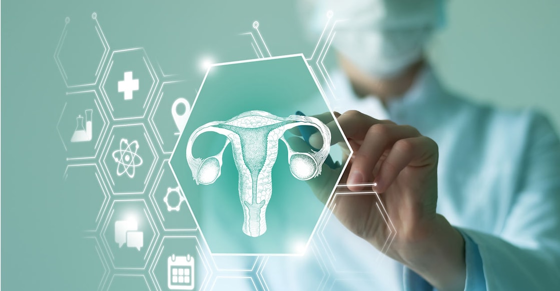 2170814975 Treatment strategies for ovarian cancer depend on various factors. Photo: mi_viri/Shutterstock