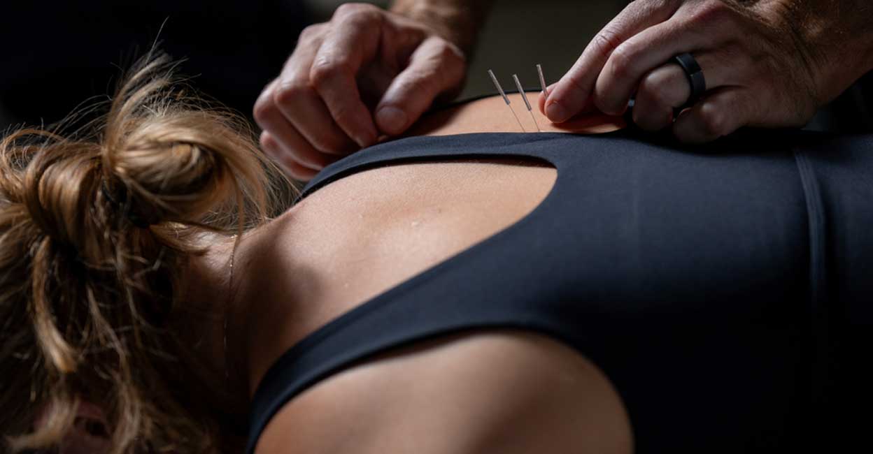 Lead author of the study Weidong Lu, from the Dana-Farber Cancer Institute.
suggested people interested in using acupuncture start with 'a short trial period' and based on the results 'engage in a long-term programme'. Photo: MimicJojo/Shutterstock