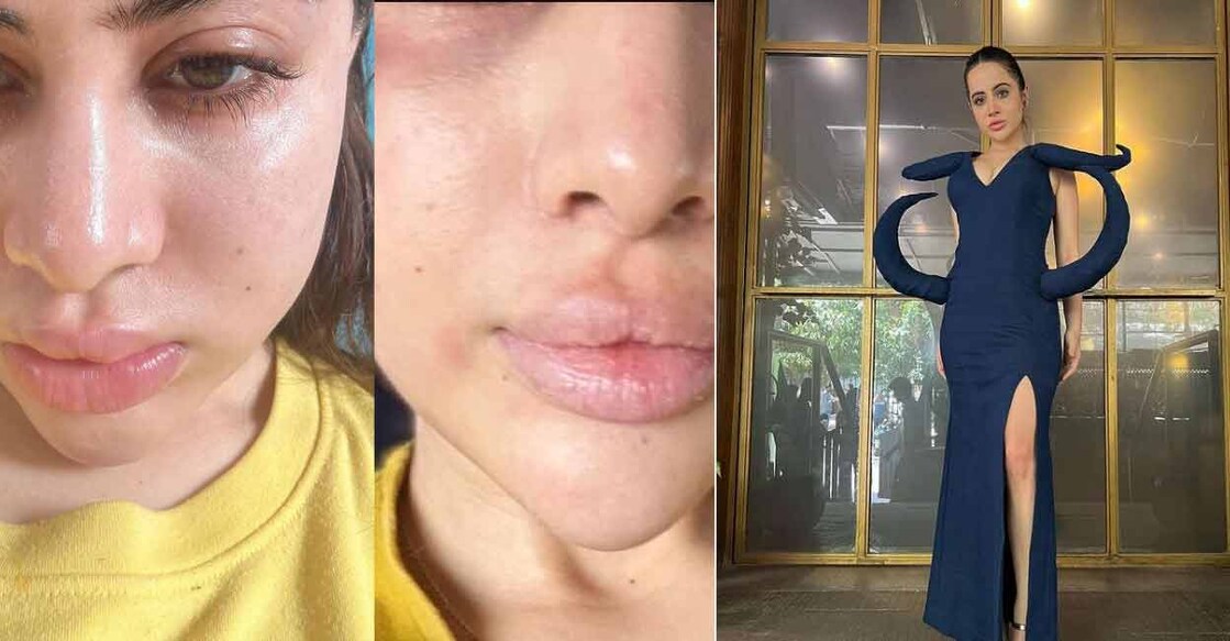 Uorfi Javed said her face "is swollen most of the time." Photo: Instagram/@urfi7