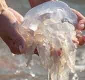 Death in Kerala due to jellyfish sting: When does it become deadly? Doctor explains