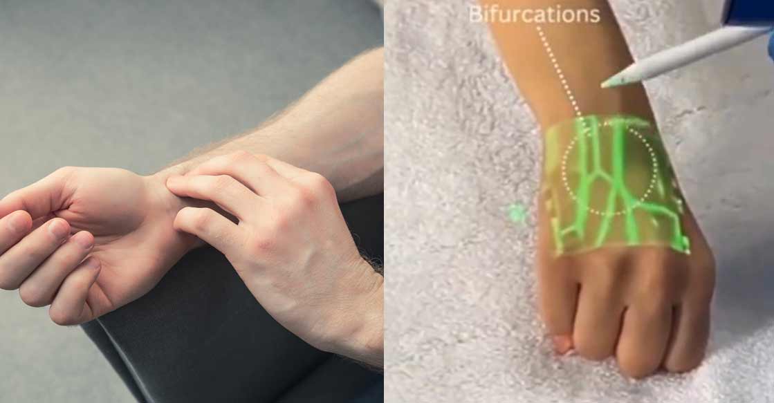 New technology detects veins using infrared light: Anand Mahindra shares video | Lifestyle Health