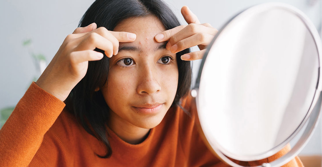 pimple Pimples on the forehead indicate problems with the digestive system, according to traditional Chinese medicine. Photo: iStock/sorrapong