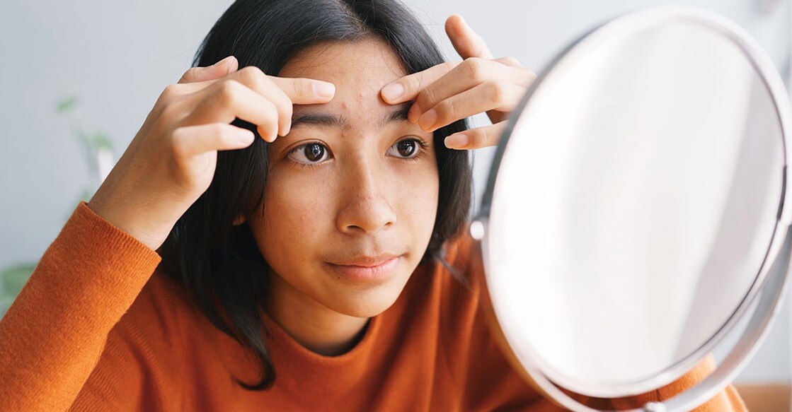 Pimples on the forehead indicate problems with the digestive system, according to traditional Chinese medicine. Photo: iStock/sorrapong