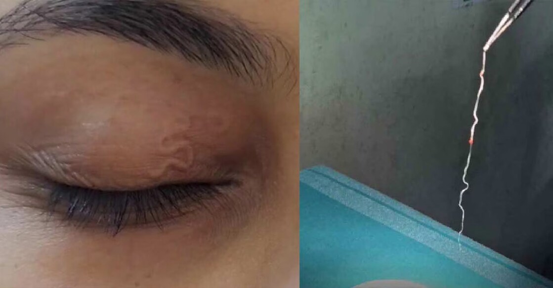 The worm was 16 cm long. Photo: Special Arrangement