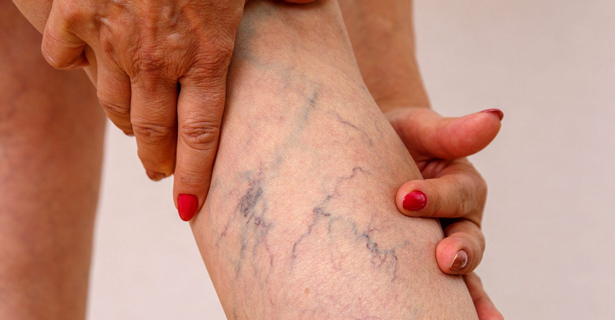 vein