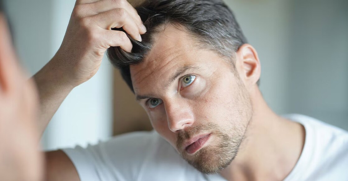 Excessive cortisol production can turn your hair grey. Photo: Shutterstock/goodluz