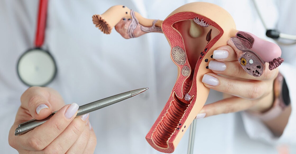 Cervical cancer develops in the cells of the cervix—the lower part of the uterus that connects to the vagina. Photo: iStock/Ivan-balvan