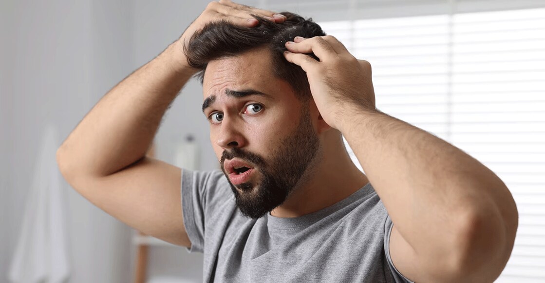 If you have mild dandruff, it could be removed by washing the hair and scalp well. Photo: iStock/New-Africa