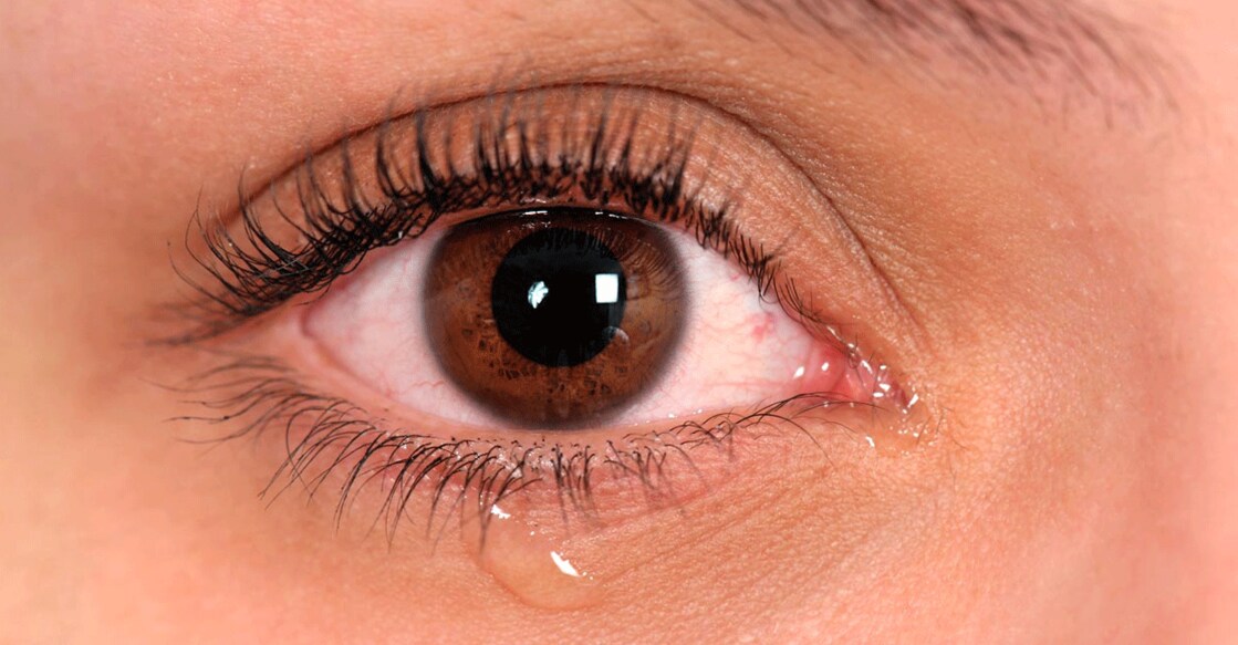 While the disease clears up on its own in many cases, a medical practitioner's help should be taken if your vision changes, your eyes constantly feel the presence of any foreign object, or you experience pain. Photo: iStock/dimarik