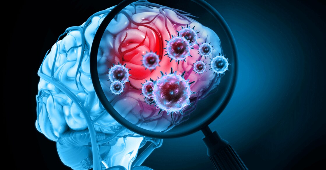 Meningitis affects people of all ages, but according to the World Health Organisation (WHO), children and newborn babies are the most at risk. Photo: Mohammed Haneefa Nizamudeen