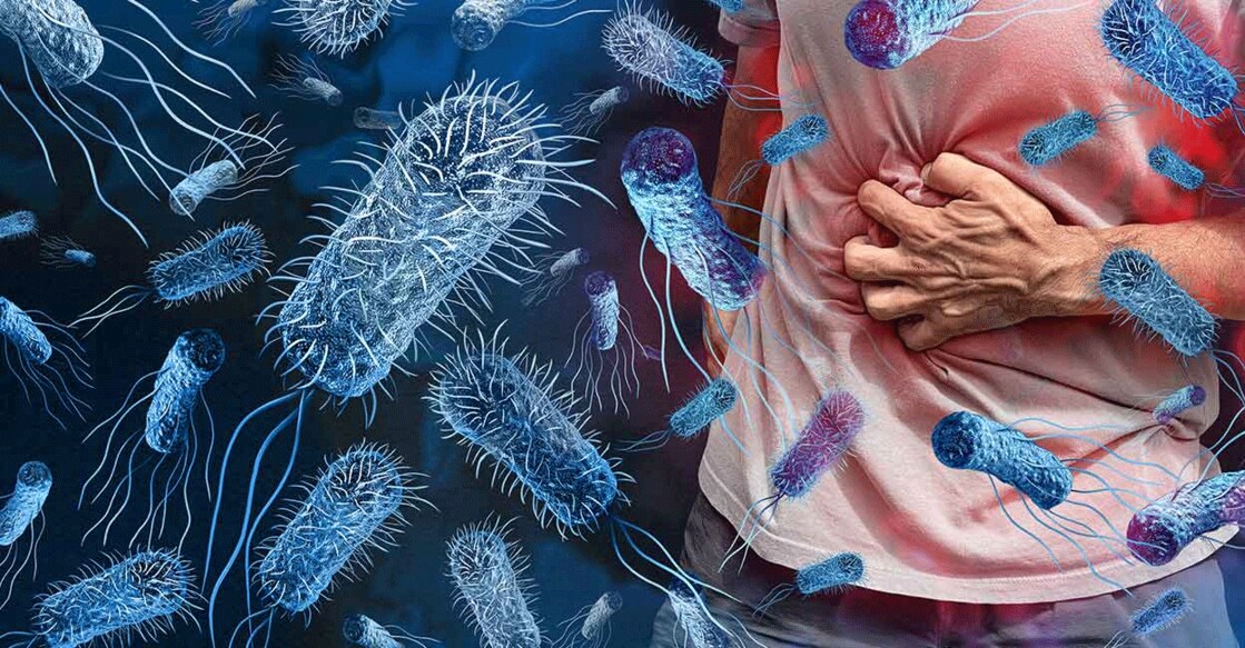 Cholera is an acute diarrheal disease caused by the bacterium Vibrio cholerae. Photo: iStock/wildpixel