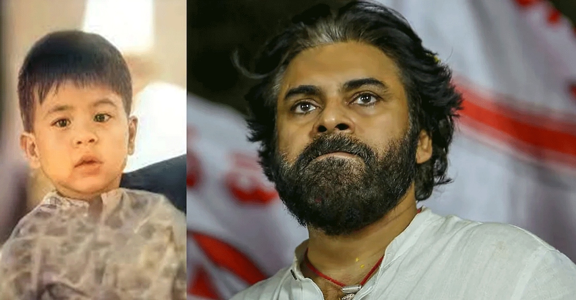 Pawan Kalyan's son Mark Shankar has undergone a bronchoscopy exam after  Singapore accident: Here's why | Mark Shankar Health Update | Singapore  School Fire Accident | Pawan Kalyan son Injured | Pawan