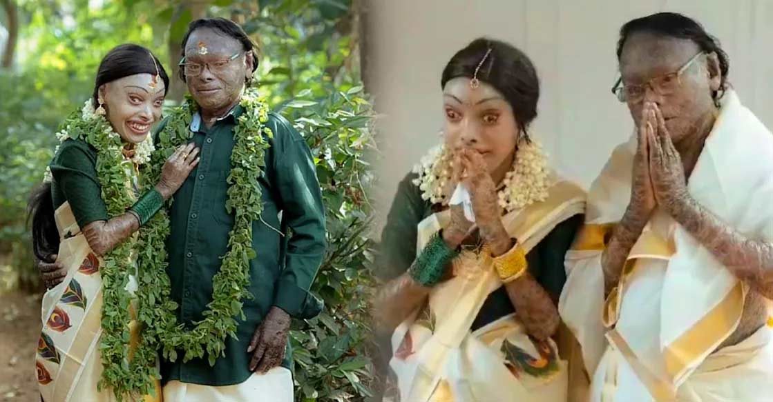 By quirk of fate, Sivan and Salini entered wedlock thanks to the rare genetic skin disease they had. Image Credit: Instagram/sivadas.siva.581