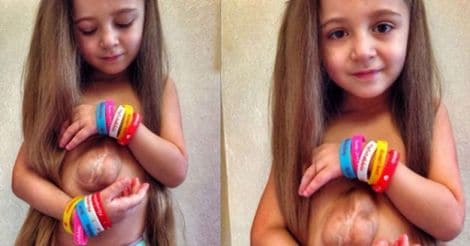 Meet the girl with her heart outside her chest