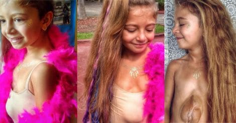 Meet the girl with her heart outside her chest