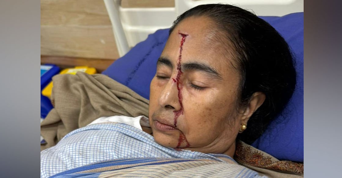 mamata-banerjee-bleeding A photograph of Mamata Banerjee shared by Trinamool. Photo: X/@AITCofficial
