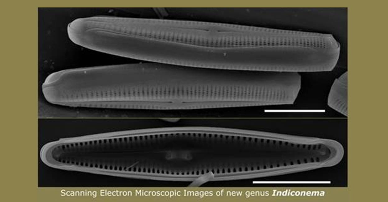 diatom The genus which has an interesting suite of features, distinguishing it from the other members in the group Gomphonemoid in terms of valve symmetry and other certain valve features. Photo: PIB
