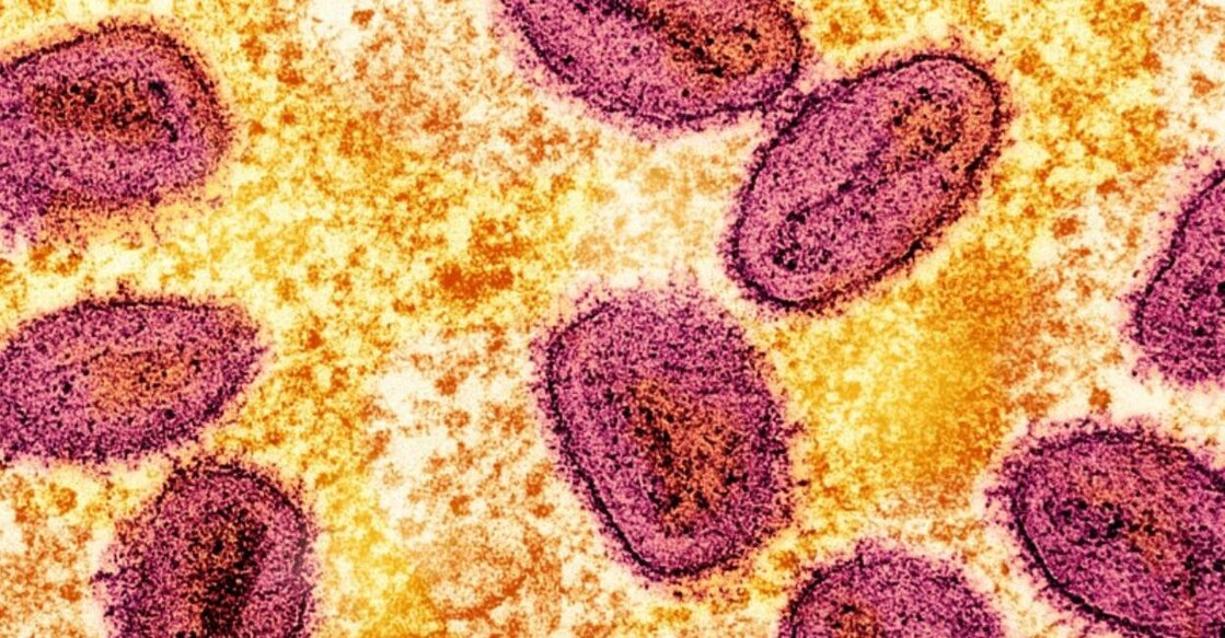 An undated colorized transmission electron micrograph of mpox virus particles (pink) found within an infected cell (yellow), cultured in the laboratory, captured at the National Institute of Allergy and Infectious Diseases (NIAID) Integrated Research Facility (IRF) in Fort Detrick, Maryland. NIAID/Handout via REUTERS/File Photo