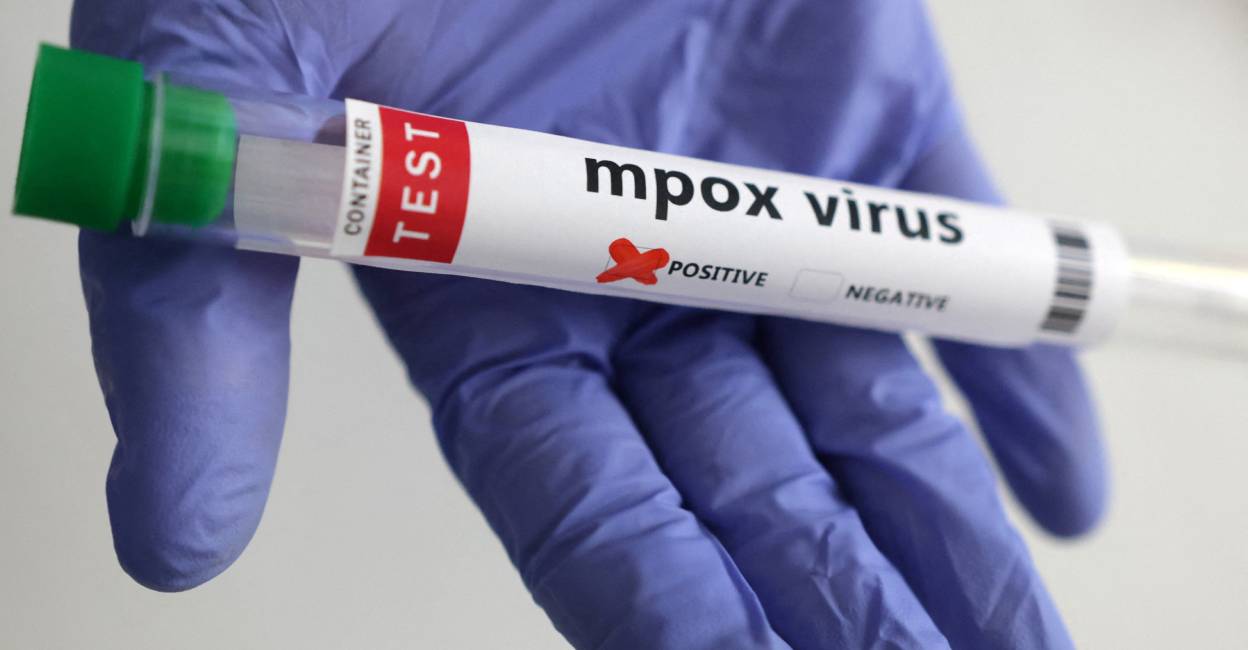 mpox-virus-test-c