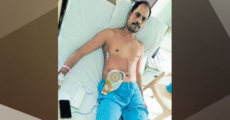 Jairam now lives with liver donated by pal