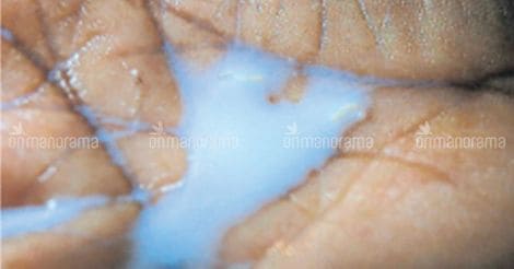 Worms in Milma milk for schoolchildren sparks protests in Shoranur 