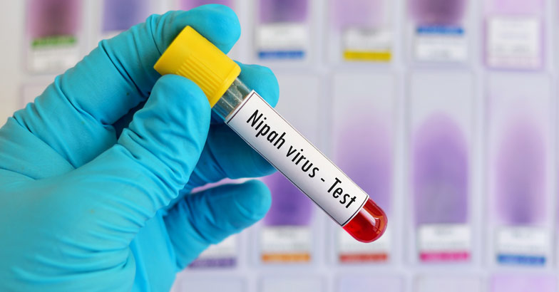 Health department issues Nipah alert in Kerala