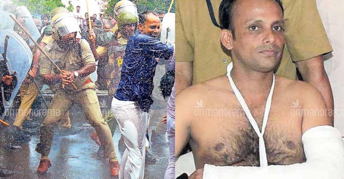 Pinarayi douses CPI anger over police action against MLA, activists