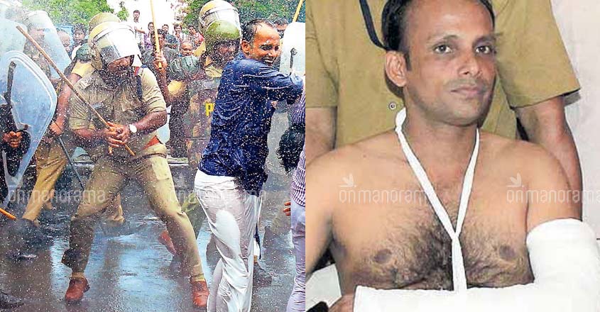 Pinarayi douses CPI anger over police action against MLA, activists