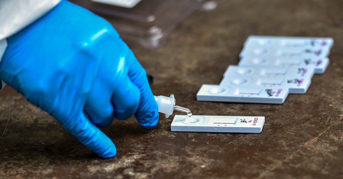 40% COVID tests at private labs, people pay for expenses
