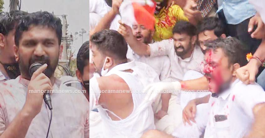 MLA VT Balram injured during lathi charge MLA VT Balram injured during lathi charge