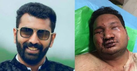 Restaurant brawl: Congress MLA's son surrenders