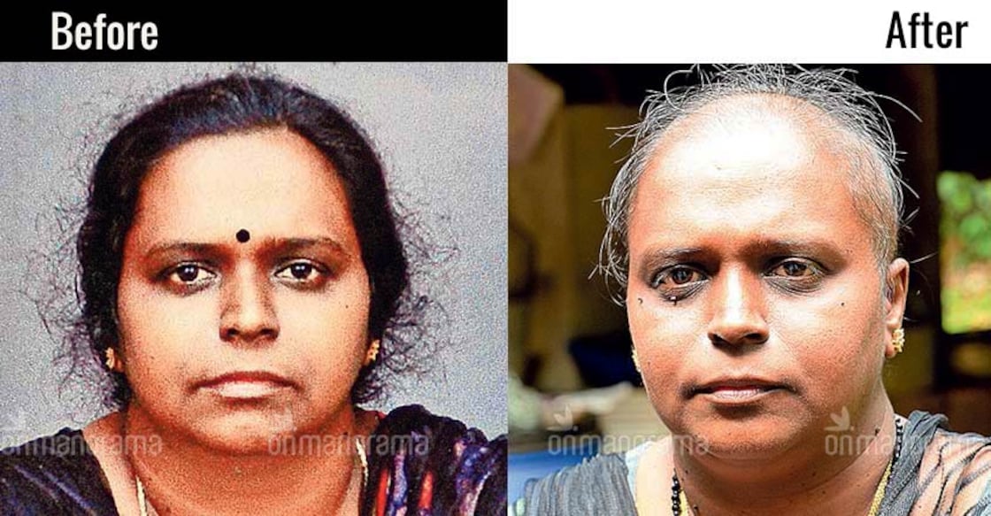 Doctors, labs booked for chemotherapy on patient without cancer