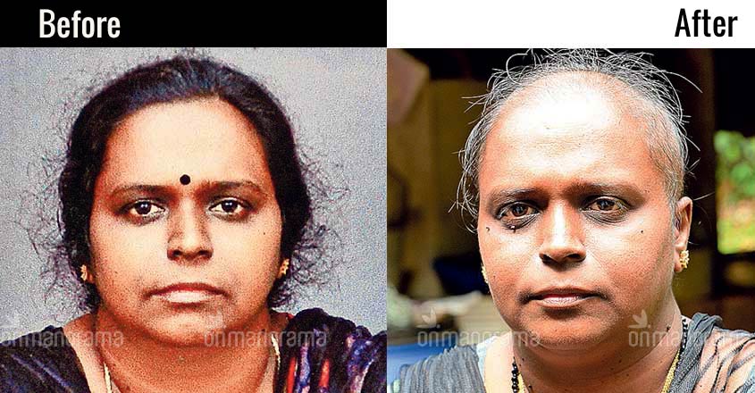 Doctors, labs booked for chemotherapy on patient without cancer