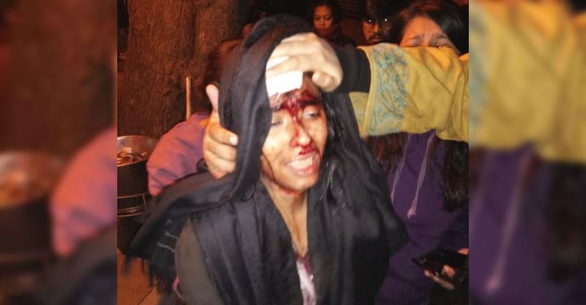 New Delhi: A girl student at JNU was hit over the eye with a rod after clashes erupted between groups of students at JNU campus in New Delhi on Jan 5, 2020. (Photo: IANS) Aishe Ghosh, the president of the Jawaharlal Nehru University Students' Union (JNUSU) was admitted to hospital after sustaining a head injury in stone pelting.