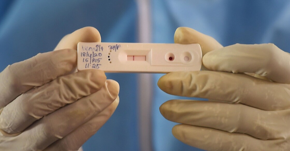 COVID-19 rapid test