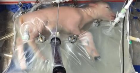 screengrab-artificial-womb