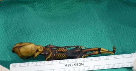 Mystery behind the bizarre 'alien' skeleton unravelled