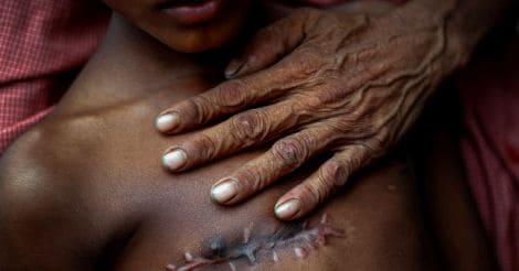 rohingya-boy-pulitzer-abidi