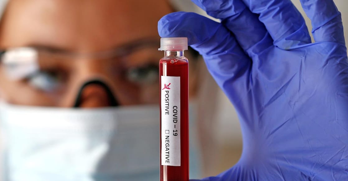 Sero survey to ascertain intensity of COVID spread in Kerala