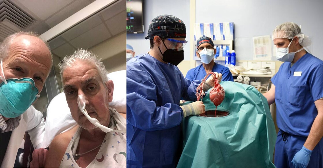 This handout photo released by the University of Maryland School of Medicine on January 10, 2022 shows surgeon Dr Bartley Griffith (L) with patient David Bennett, Sr., who received a heart implant from a genetically modified pig, in Baltimore, Maryland, in January 2022. (R) Surgeons performing the transplant in Baltimore, Maryland, on January 7, 2022. Photo: UNIVERSITY OF MARYLAND SCHOOL OF MEDICINE/AFP