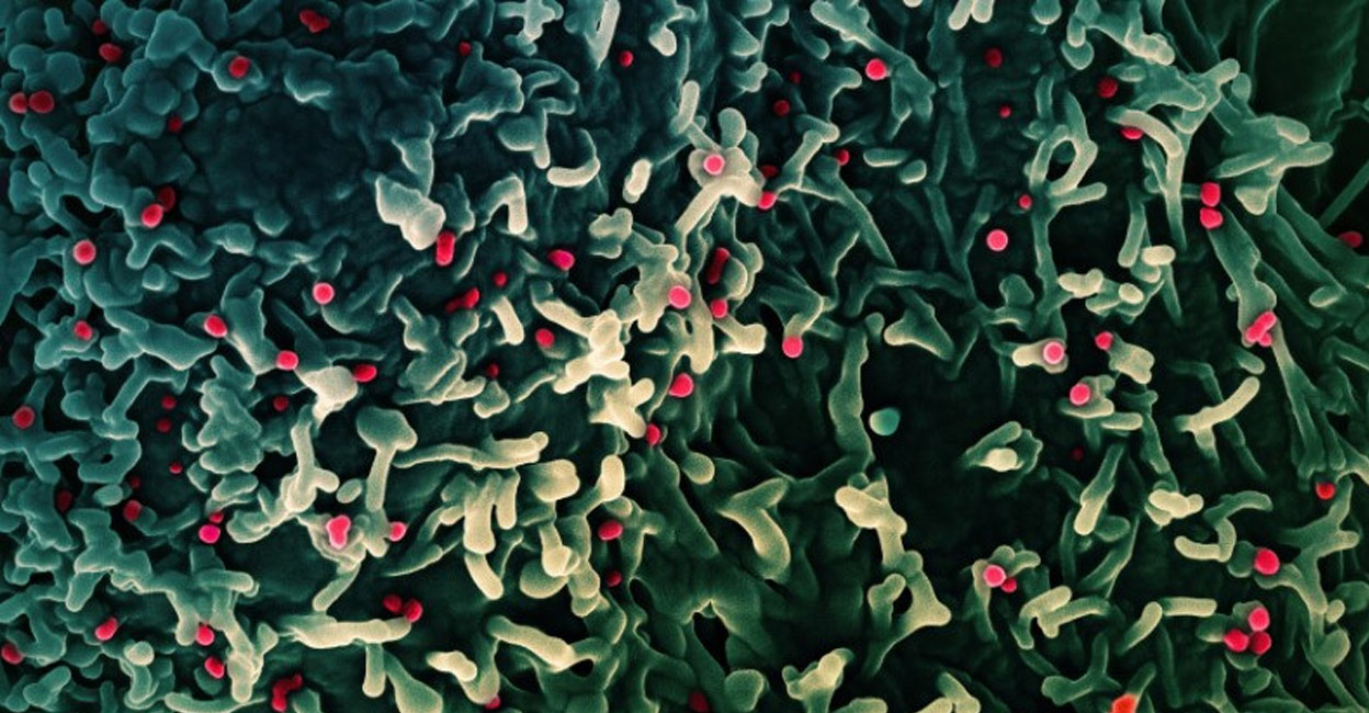 An undated colorized scanning electron micrograph of mpox virus (red) on the surface of infected VERO E6 cells (green). NIAID/Handout via REUTERS