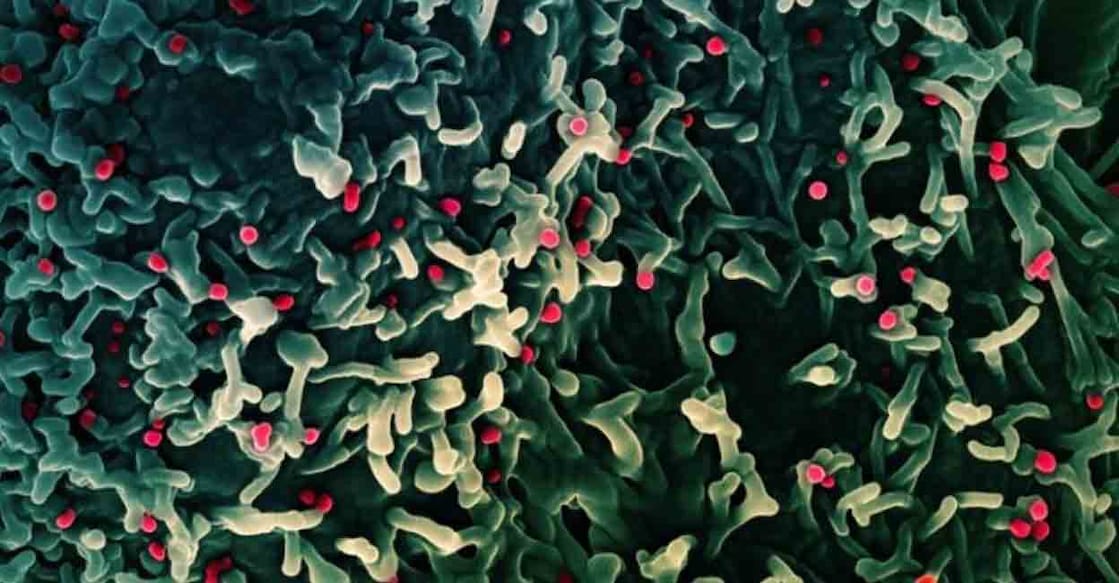 An undated colorized scanning electron micrograph of mpox virus (red) on the surface of infected VERO E6 cells (green). NIAID/Handout via REUTERS