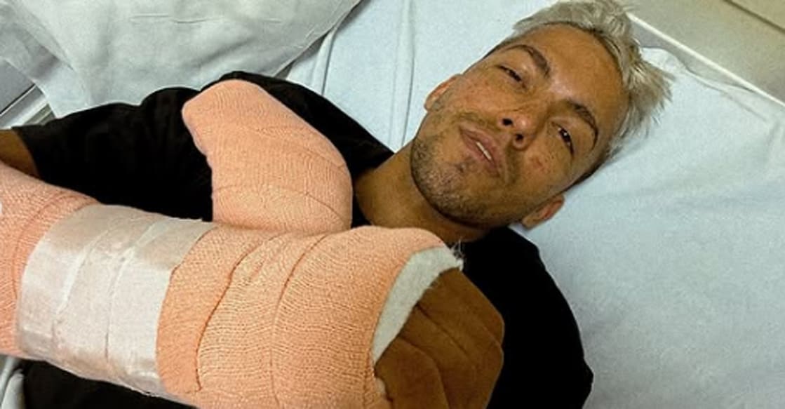 harith-noah-wrist-surgery Harith Noah underwent surgery on his wrist after a crash in Dakar Rally 2025. Photo: Harith's Instagram page