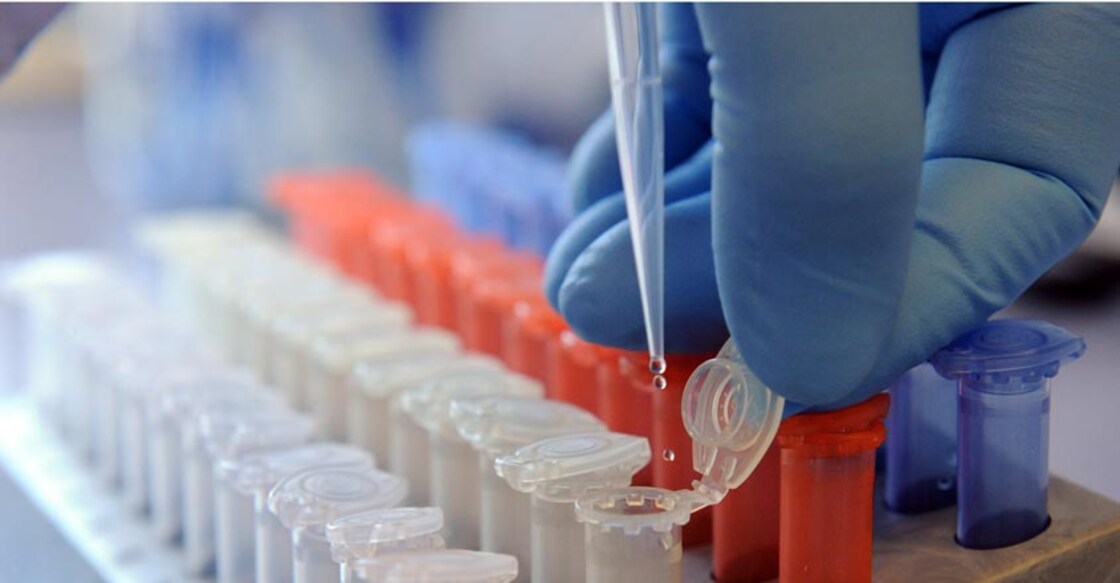 E.coli risk forces Tokyo officials to cancel swim events at Paratriathalon World Cup