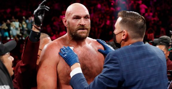 Tyson Fury Tyson Fury