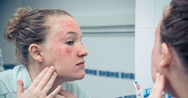 Allergy iStock photo