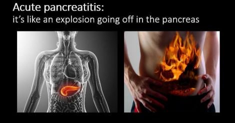 Everyday Health | Drinker’s nightmare: the curious case of the pancreas, an organ capable of destroying itself