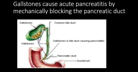 Everyday Health | Drinker’s nightmare: the curious case of the pancreas, an organ capable of destroying itself