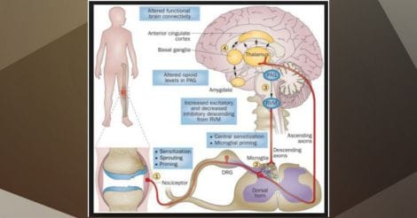 Everyday Health | The basics about pain and painkillers: a user’s guide