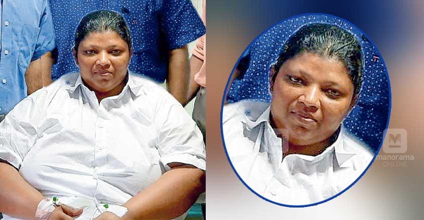 Woman, weighing 135kg, undergoes bariatric surgery in Alappuzha Woman, weighing 135kg, undergoes bariatric surgery in Alappuzha